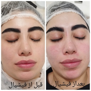تصویر گالری